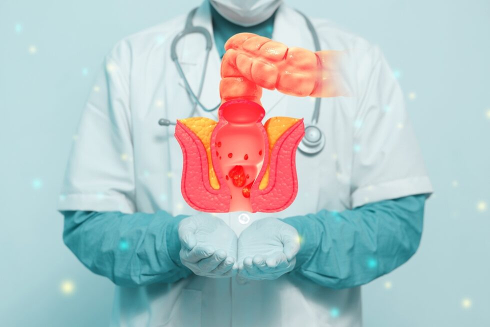 Best Hemorrhoid Surgeon in Dubai Best Hemorrhoid Surgery